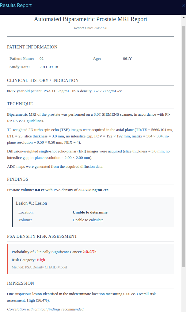 Automated biparametric prostate MRI report with findings and risk assessment