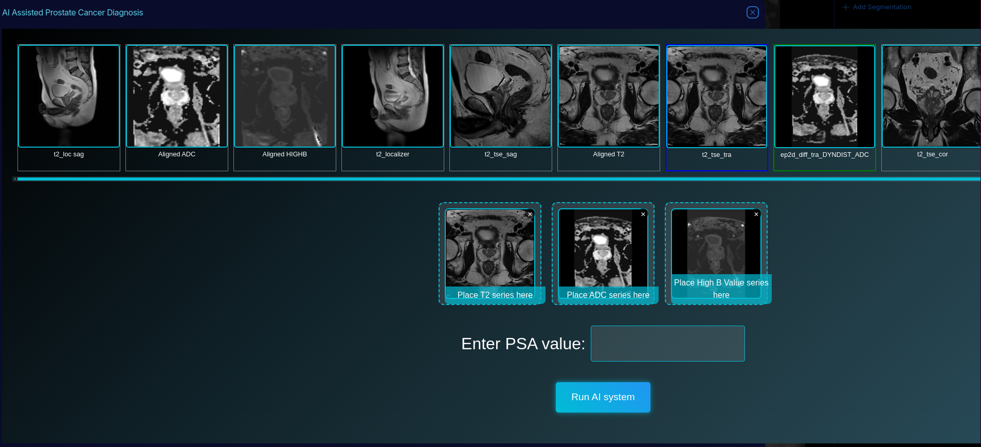 Drag-and-drop series selection interface for T2, ADC, and High B Value series