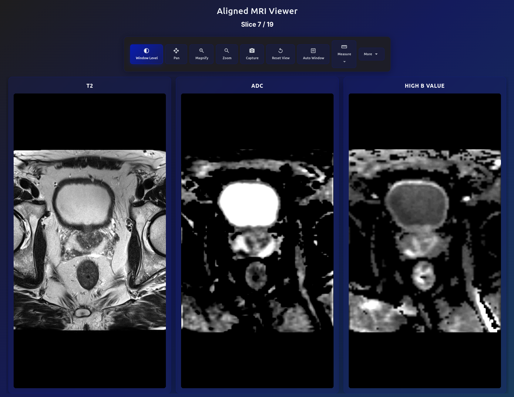 Auto-windowed biparametric MRI display with optimized window/level settings