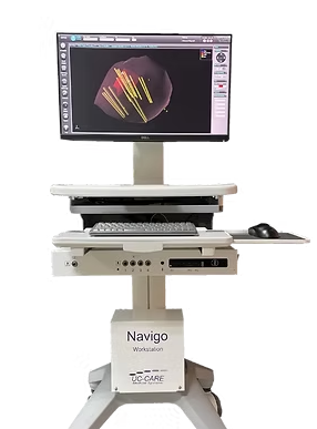 Philips Navigo MRI/ultrasound fusion biopsy workstation